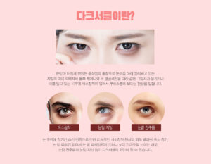 강남 신논현역 피부과 성형외과 라벨라 다크서클이란? 눈밑이 어둡게 보이는 증상들의 통칭으로 눈꺼풀 아래 둘러싸고 있는 지방의 막이 약해져서 볼록 튀어나와 코 옆골격선을 따라 검은 그림자가 생기거나 이를 덮고 있는 피부에 색소침착이 있어서 푸르스름해 보이는 현상을 말합니다. 눈 주위에 장기간 습진 반응으로 인한 이차적인 색소침착 현상과 피부 멜라닌 색소 증가, 눈 밑 피부가 얇아서 눈 밑 피하정맥이 드러나 보이고 어두워 보이는 경우, 눈밑 잔주름과 눈밑 지방 등이 다크서클의 원인이 될 수 있습니다.