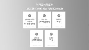효과 남자다운 완벽한 직선코로 조각같은 옆모습 정면, 측면 모두 자신감 상승 입체적인 이미지 남자다운 강인한 이미지 또렷한 인상