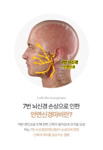 강남 신논현역 신논현 라벨라의원 안면신경마비 도수치료