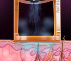 젠틀맥스프로_원리1