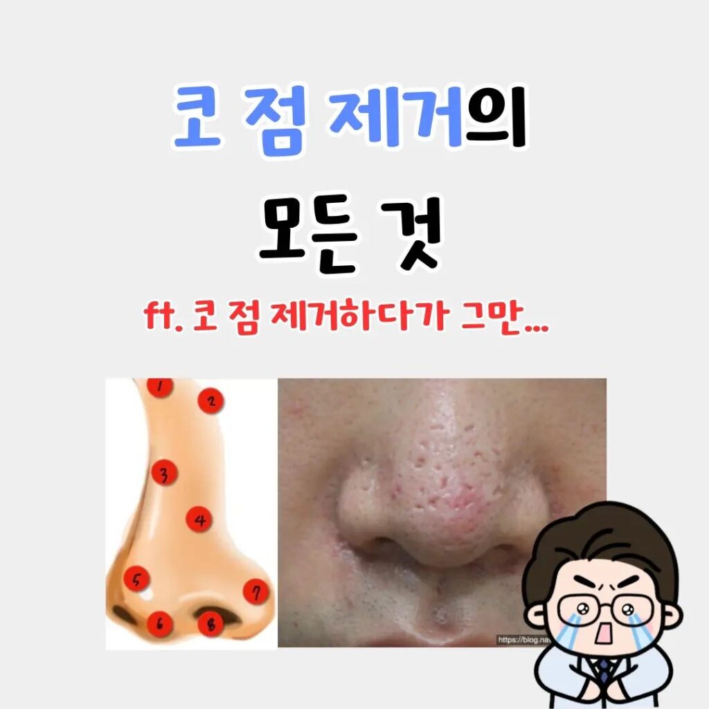 코 점제거의 모든것! feat. 장인이!