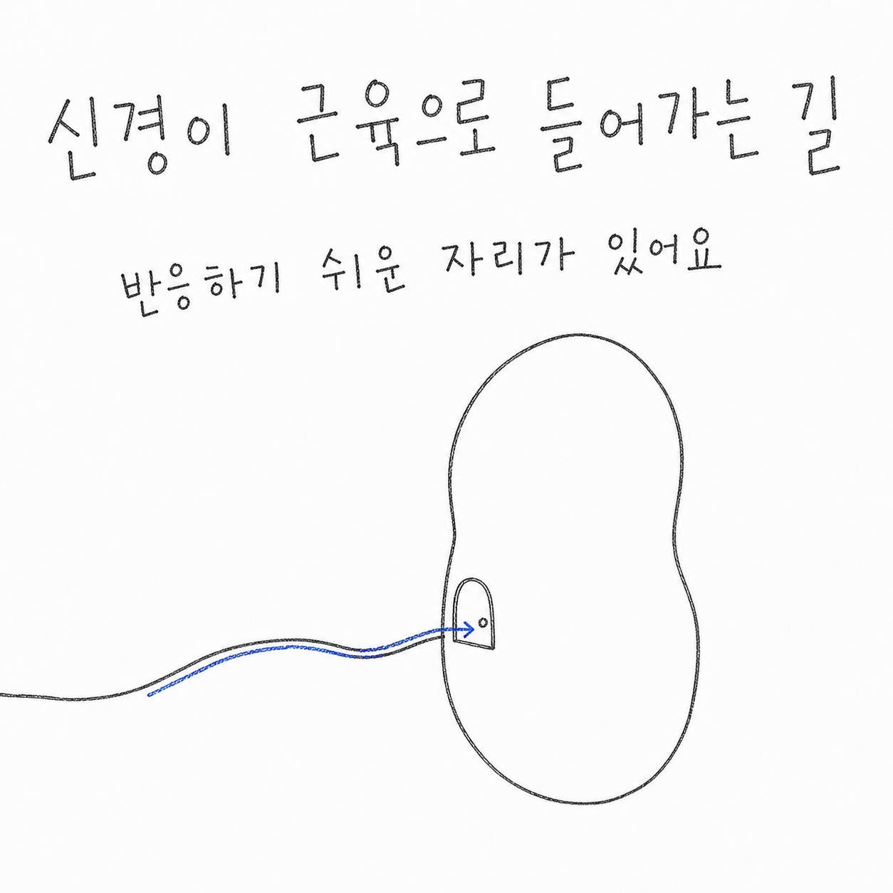 신경이 근육으로 들어가는 길. 반응하기 쉬운 자리가 있어요.