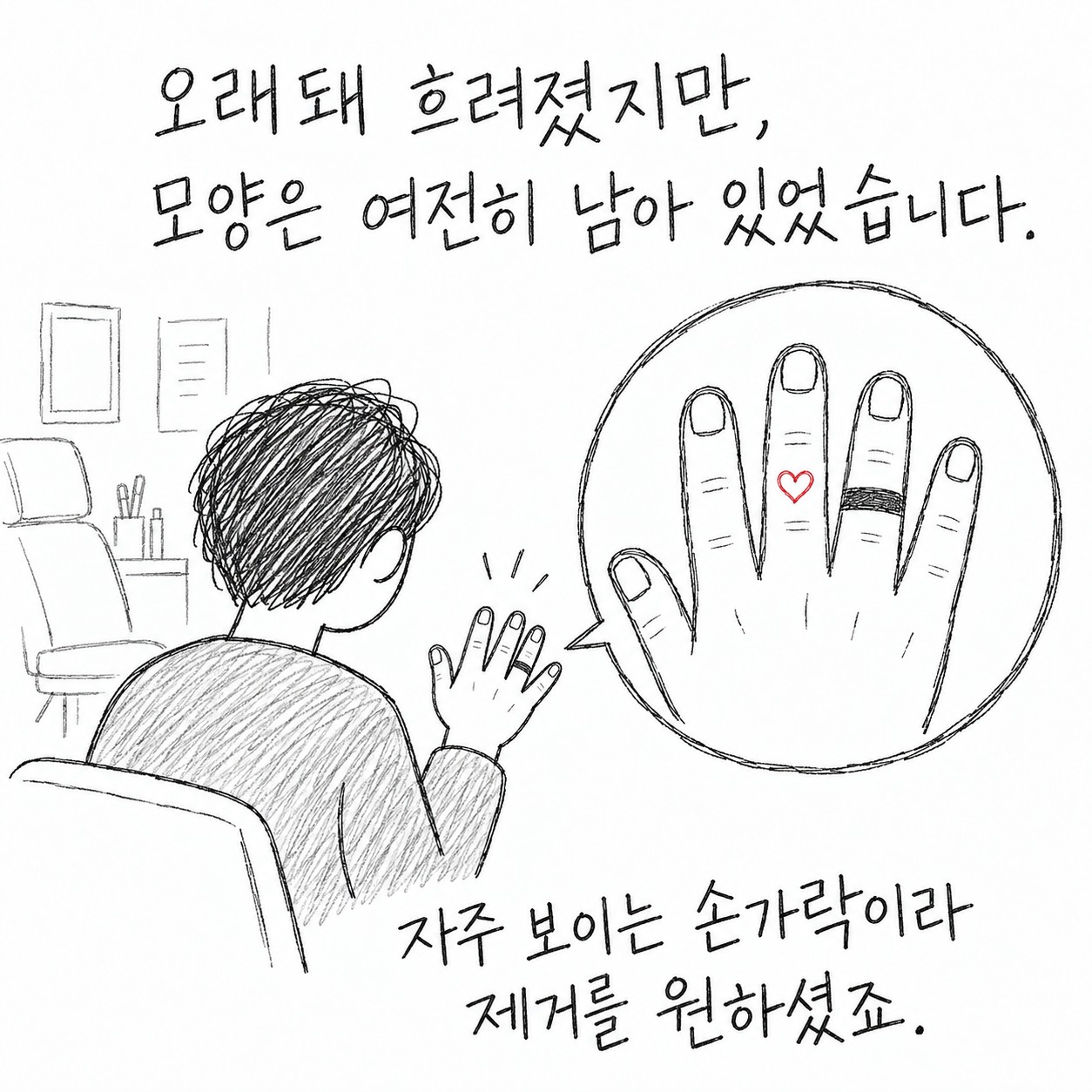 오래돼 흐려졌지만, 모양은 여전히 남아 있었습니다. 자주 보이는 손가락이라 제거를 원하셨죠.