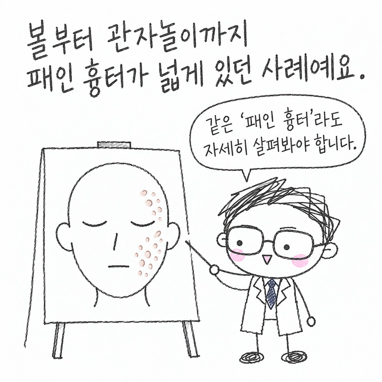 볼부터 관자놀이까지 패인 흉터가 넓게 있던 사례예요. 같은 패인 흉터라도 자세히 살펴봐야 합니다.