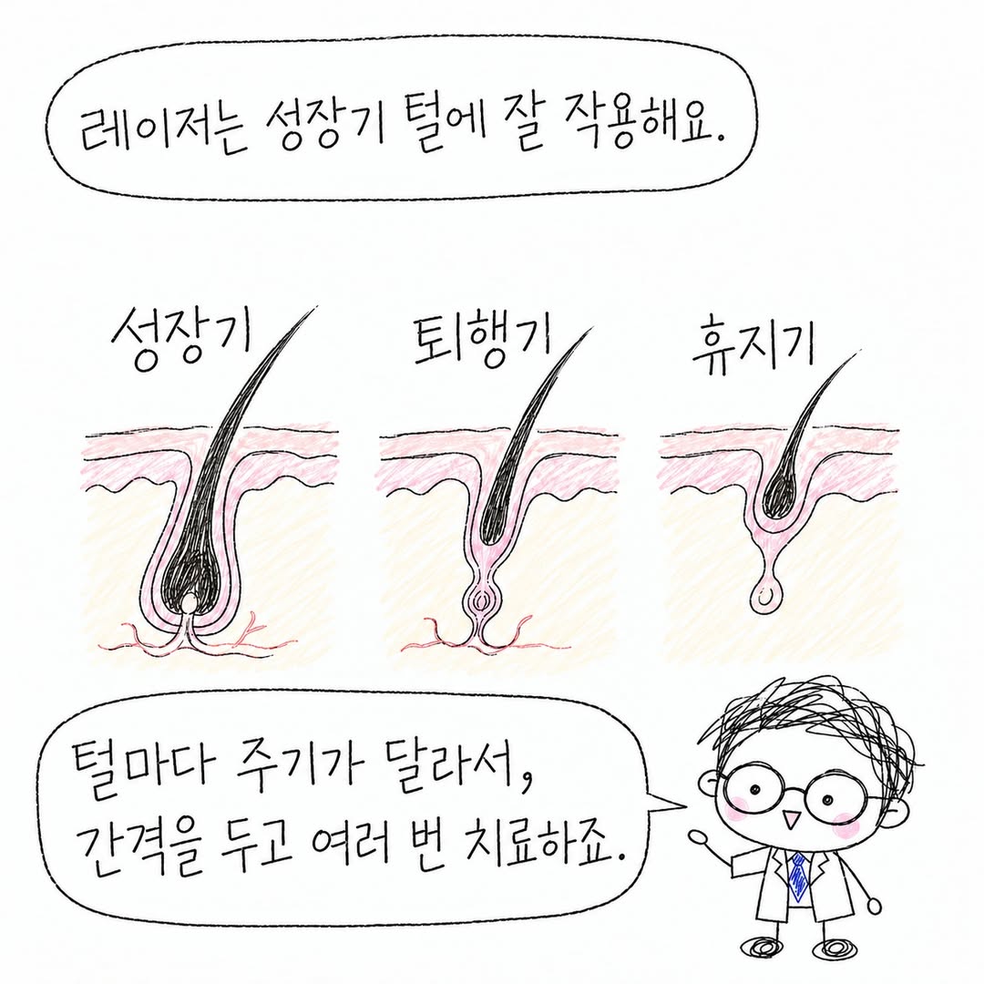 레이저는 성장기 털에 작용하므로 간격을 두고 여러 번 치료해요.