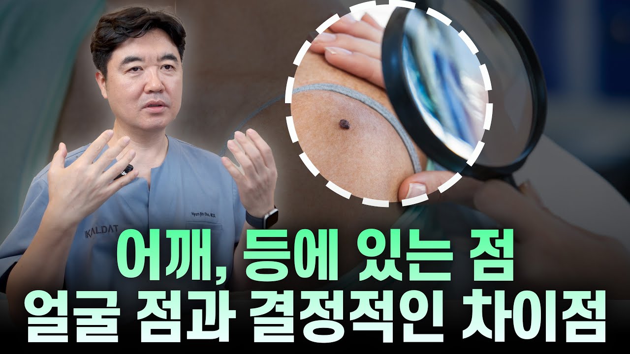 등과 어깨에 있는 점이 얼굴점과 다른 이유를 설명하는 조현진 대표원장 영상 썸네일