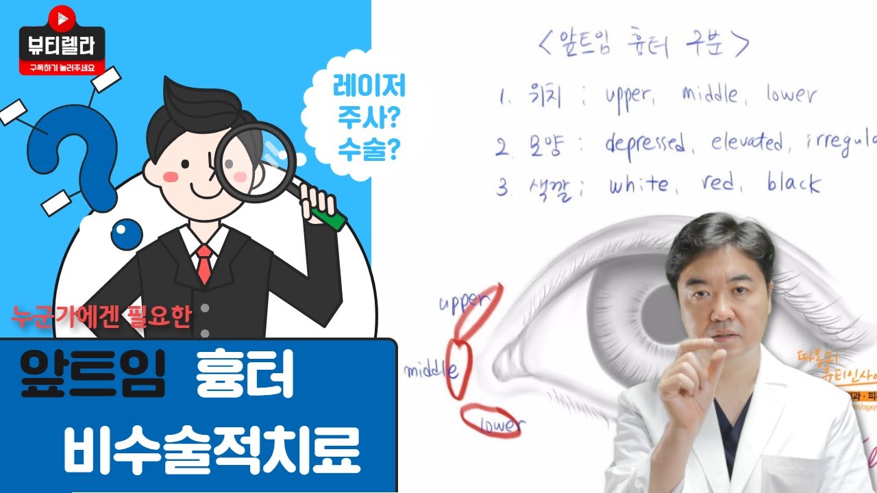 앞트임 흉터의 구분과 비수술적 치료를 설명하는 조현진 대표원장 영상 썸네일