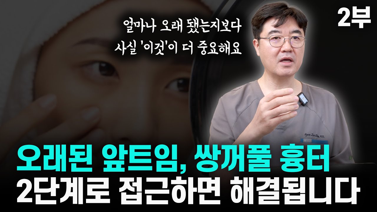 앞트임, 쌍꺼풀 흉터? 오래된 흉터를 치료하는 2단계 접근법 (2부)