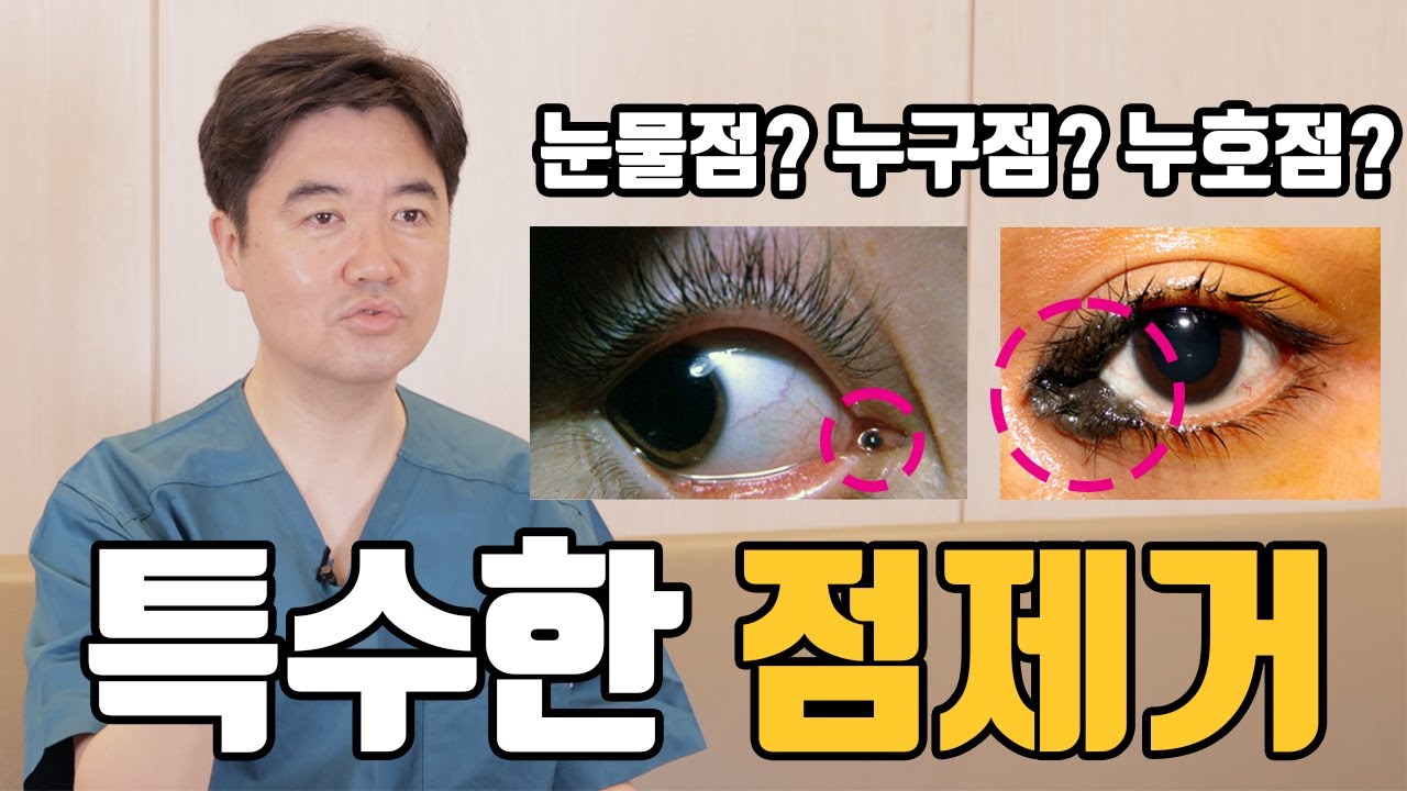 눈물점 누구점 누호점 등 눈주변 특수부위 점 제거를 설명하는 조현진 대표원장 영상 썸네일