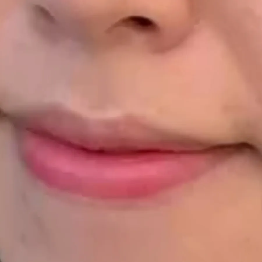 입주변점 제거 후