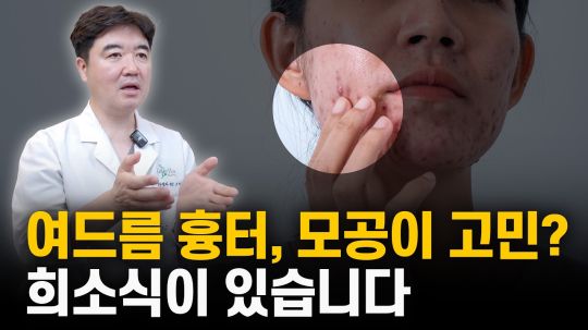 여드름 흉터, 모공 치료? 기존 치료보다 훨씬 좋은 방법이 나왔습니다.