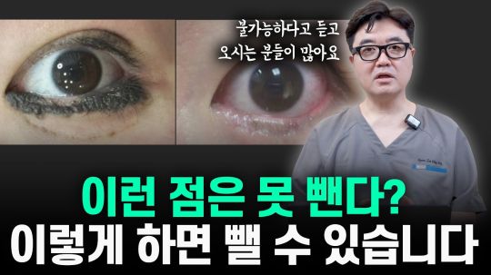 제거가 불가능한 점? 방법이 없는 건 아닙니다.