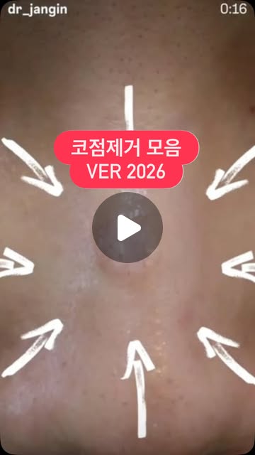 장인닥터 콧구멍점제거 Instagram Reels