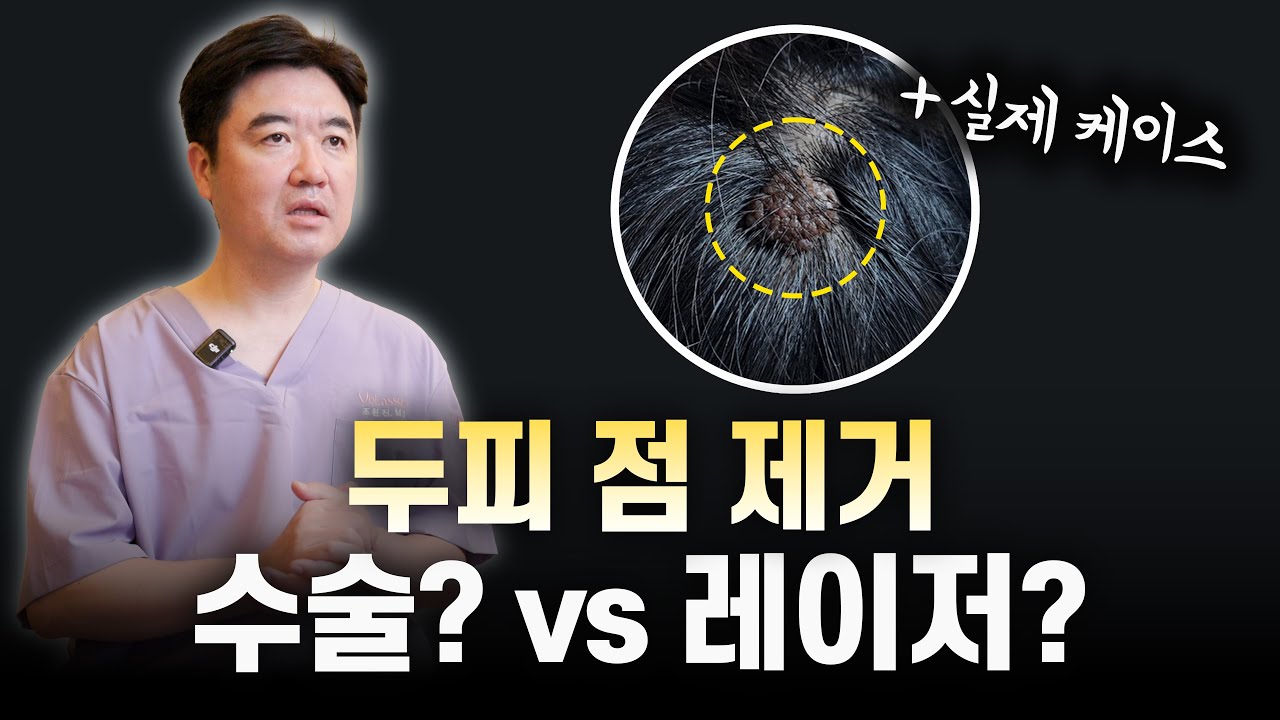 제거한 자리에 머리카락이 다시 자라는지 설명하는 두피점 제거 영상 썸네일